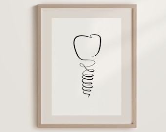 Zahn Implant Druckbare Wandkunst, Minimalistischer Dental Kunstdruck, Zahnarzt Kunst Geschenk, Orth dentalistische Linie Malerei, One Line Medizinische Illustration.