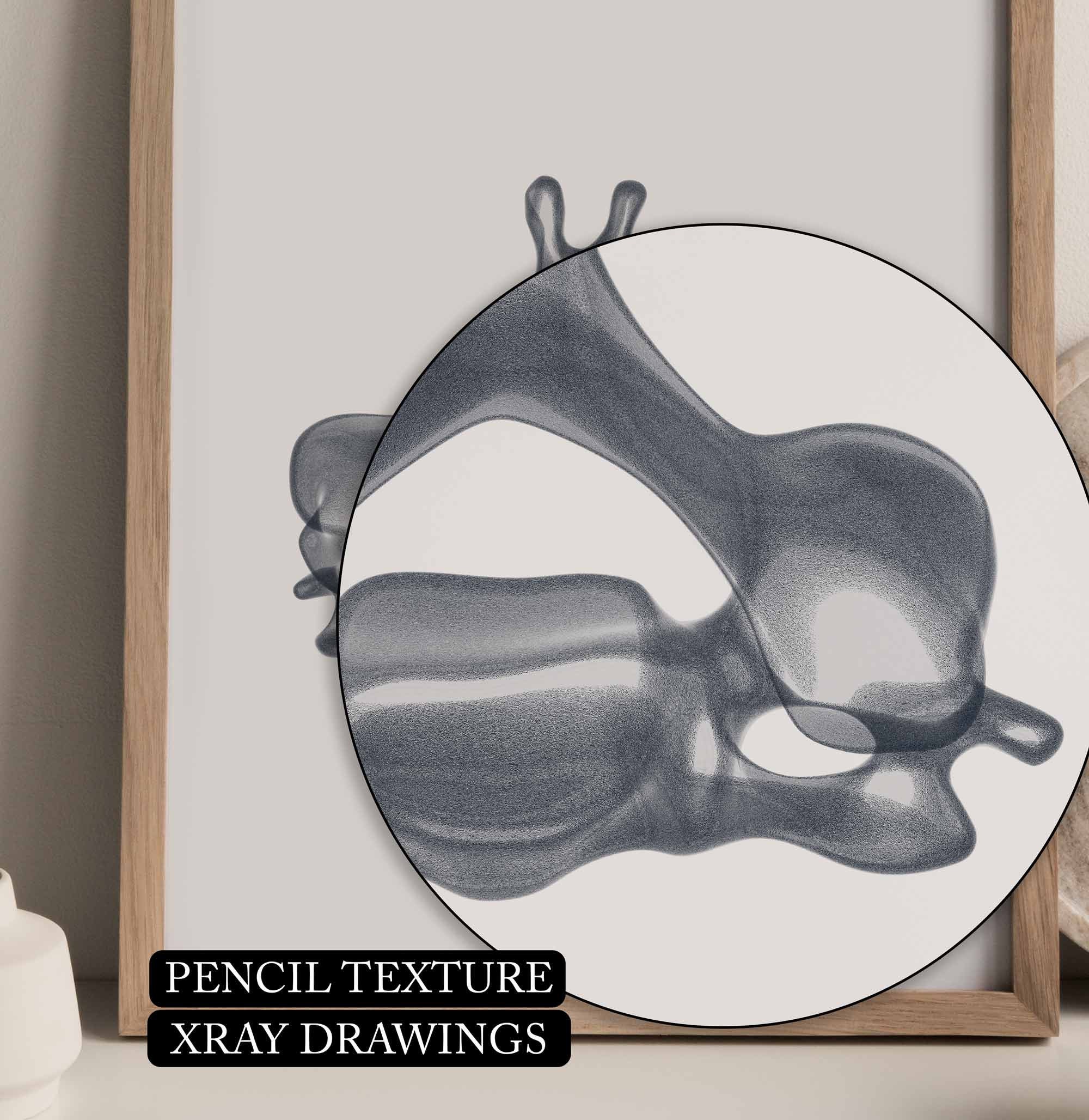 18 Xray Human Skeleton Drawings, Anatomy Printable Wall Art Set ...