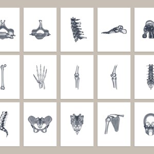 18 Xray Human Skeleton Drawings, Anatomy Printable Wall Art Set ...