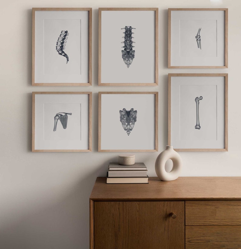 18 Xray Human Skeleton Drawings, Anatomy Printable Wall Art Set ...
