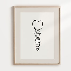 Dental Implant Printable Art, Abutment Tooth Line Illustration, Denture Sketch Drawing, Dentist Abstract Wall Art, One Line Dentistry Poster