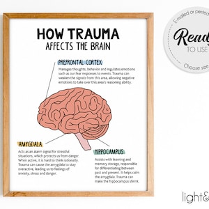 How trauma affects the brain, human brain poster, Brain anatomy poster, psychology poster, Mental health poster, Therapy Office Decor, CBT