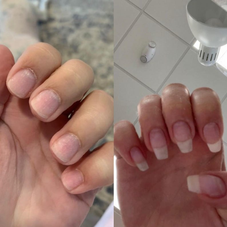 May include: A split image showing two hands with nails. The left hand has short, unpolished nails. The right hand has longer nails with a French manicure style, featuring a white tip and a clear base.
