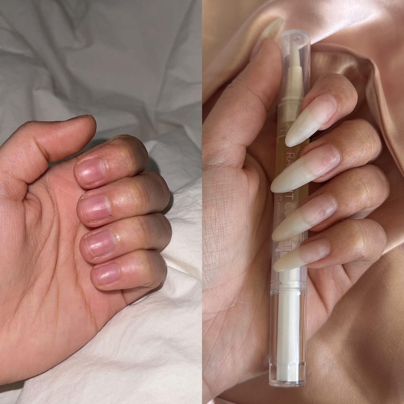 May include: A split image shows two hands. The left hand has short, unmanicured nails. The right hand holds a clear nail treatment pen with long, manicured nails. The pen has a white base and a clear cap.