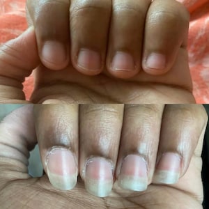 May include: Close-up of a hand with short, unpolished fingernails. The nails are a natural pink color, with a slight white edge. The skin tone is medium brown.