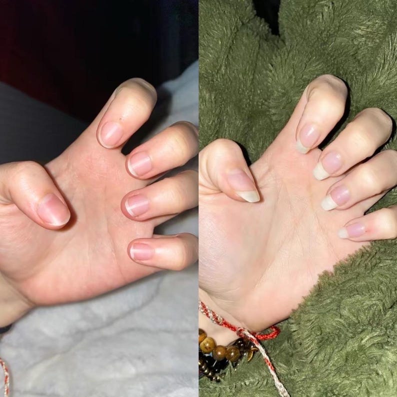 May include: Two hands with natural nails are shown side by side. One hand has short, trimmed nails, while the other has longer, more squared-off nails. The skin tone is fair, and the background is a soft, neutral color.