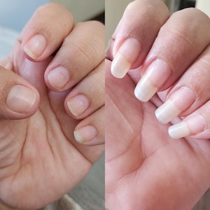 May include: A split image shows a hand with short, unmanicured nails next to a hand with long, artificial nails. The natural nails are short and unpolished. The artificial nails are long, square-shaped, and have a natural-looking color.
