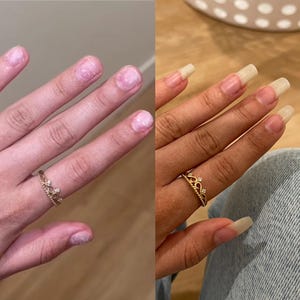 May include: A before-and-after comparison of fingernails. The left side shows short, damaged nails, while the right side displays long, artificial nails. A gold crown ring with small clear stones is on the ring finger in both images.