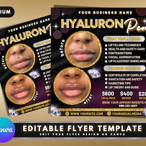 Hyaluron Pen Flyer, DIY Flyer Template Design, Hyaluron Pen Trainings Flyer, Hyaluron Pen Akademie, Lippenfüller Kurs Business Flyer
