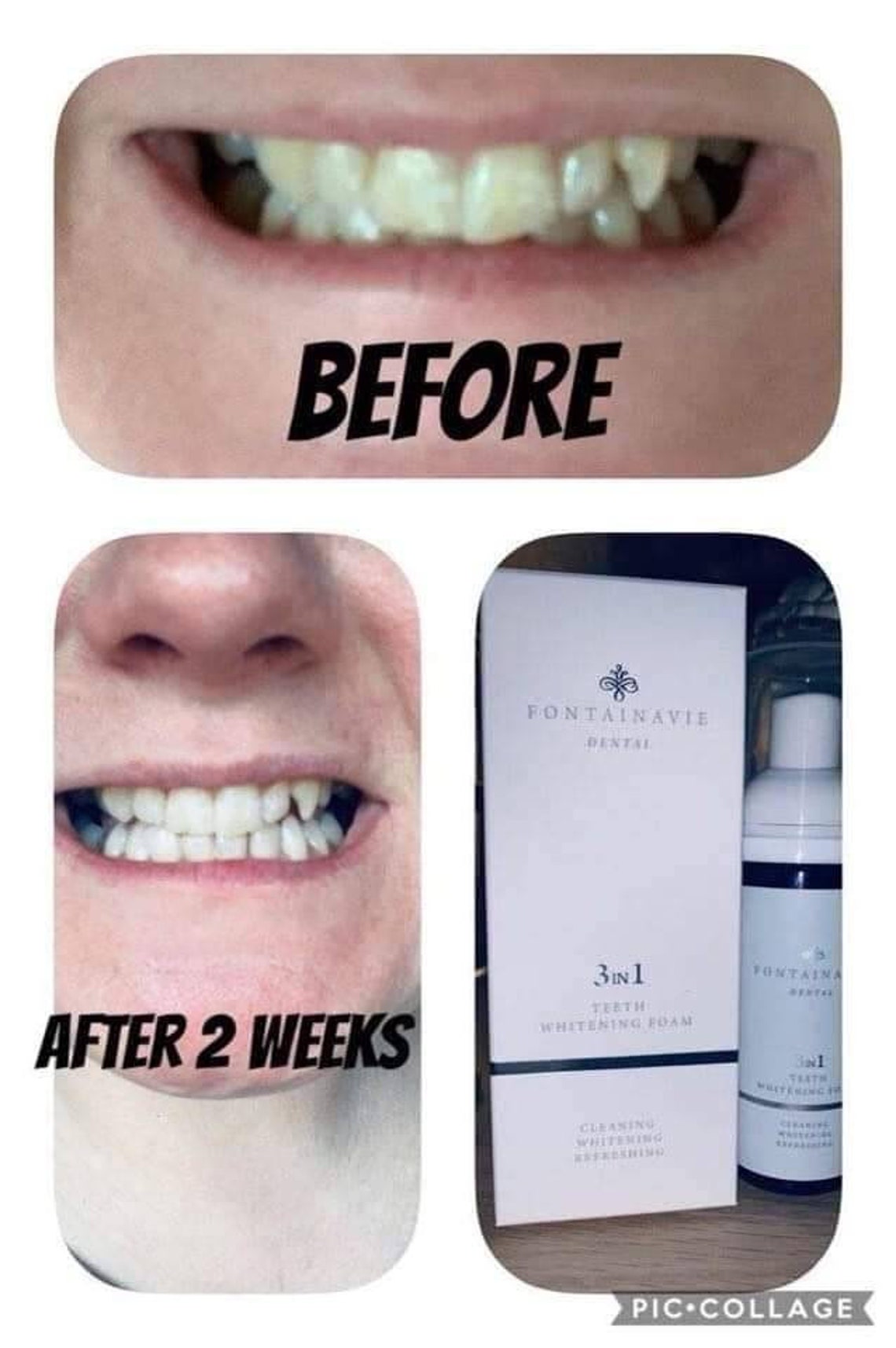 Fontainavie 3 in 1 Teeth Whitening Foam Fm World Free uk Etsy