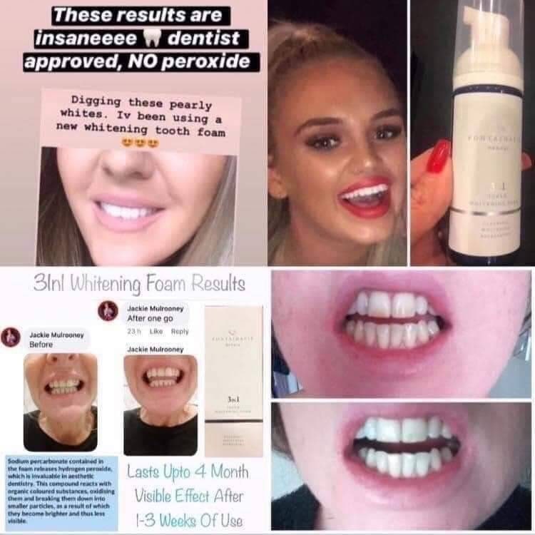 Fontainavie 3 in 1 Teeth Whitening Foam Fm World Free uk Etsy