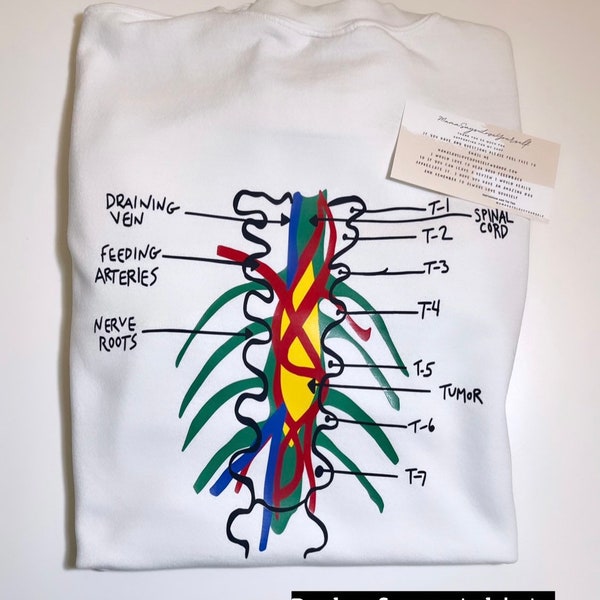 Grey's Anatomy Tumor Sweatshirt / Tumor on the Wall Sweatshirt / Gift for a Fan / Grey's Anatomy / Birthday Gift / Personalized Gift