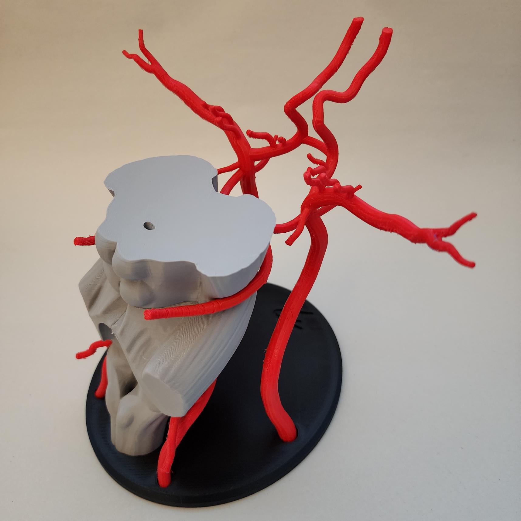 Brain Arteries/circle of Willis 3D Model - Etsy