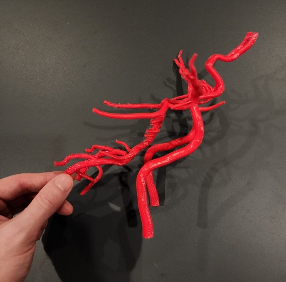 Brain Arteries/circle of Willis 3D Model - Etsy
