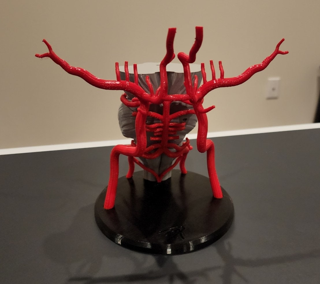 Brain Arteries/circle of Willis 3D Model - Etsy