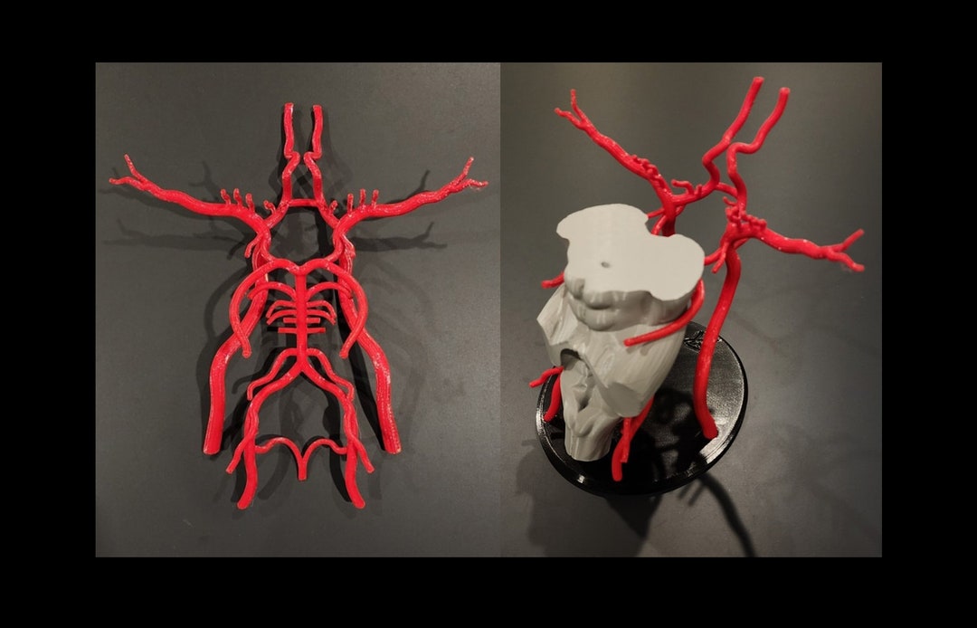 Brain Arteries/circle of Willis 3D Model - Etsy