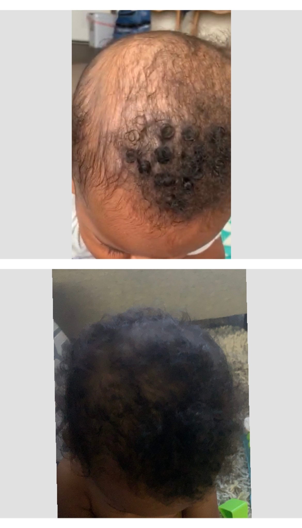 Baby Hair Oil, Cradle Cap Oil, Toddler Hair Oil, Kids Hair Oil, Toddler Hair Oil, Kids Hair Care
