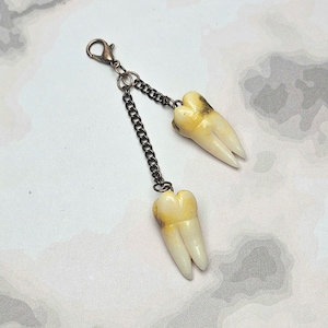 Molars with cavities charm gold