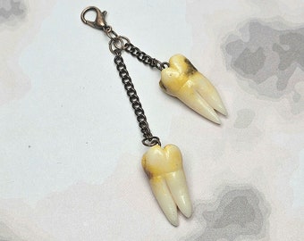 Molars with cavities charm gold