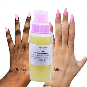 Könnte beinhalten: Eine Flasche gelber Flüssigkeit mit einem rosa und weißen Deckel, beschriftet mit "Le Beau Cosmétique Dark Knuckles Remover". Das Bild zeigt einen Vorher-Nachher-Vergleich von Händen, wobei die "Nachher"-Hand heller erscheint.