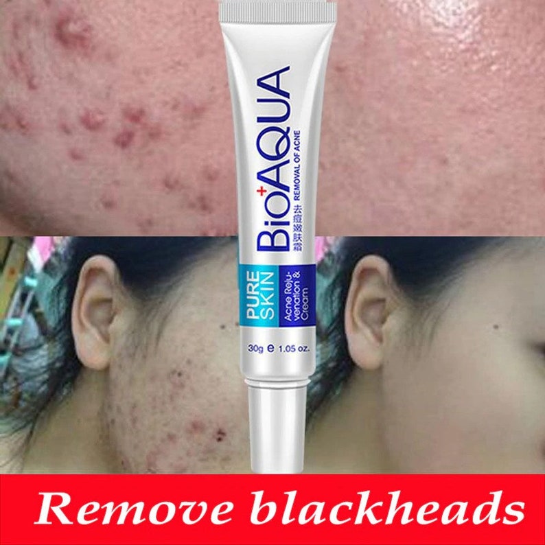 bioaqua blackhead cream