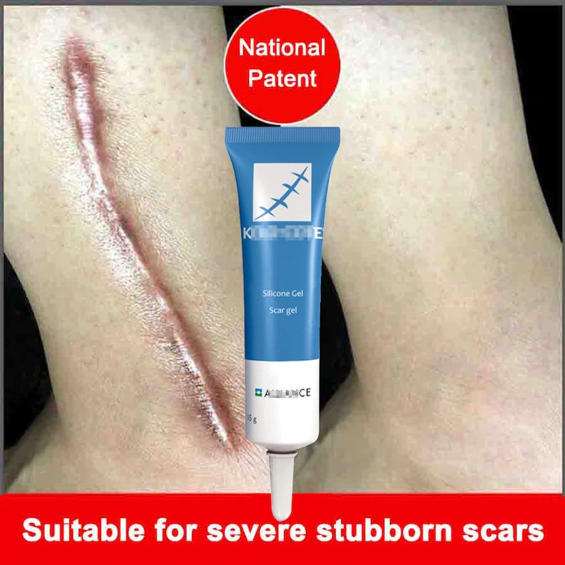 Scar Removal Cream Acne Scars Gel Stretch Marks Surgical Scar Etsy