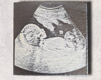 Baby Scan Photo Slate coaster | Baby scan, Baby shower gift, Baby scan gift, Ultrasound print, Pregancy scan, Pregnancy announcement