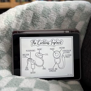 以下が含まれることがあります： 蝸牛インプラントの白黒線画イラスト。イラストは、マイクロホン、マグネット、コイル、レシーバー、電極アレイなど、インプラントのさまざまな部分を説明しています。イラストの上には、吹き出しの中に「The Cochlear Implant」というテキストが書かれています。