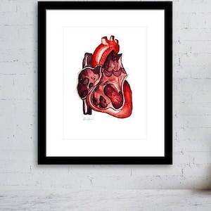 Right Ventricle Watercolor Print - Cardiology Art - Anatomy Wall Art - Heart Painting - Medical Gift - Surgeon Gift - Graduation gift