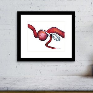 Clipped Aneurysm Watercolor Print - Surgery Art - Neurosurgery Art - Surgeon Gift - Physician Assistant Art - Graduation Gift