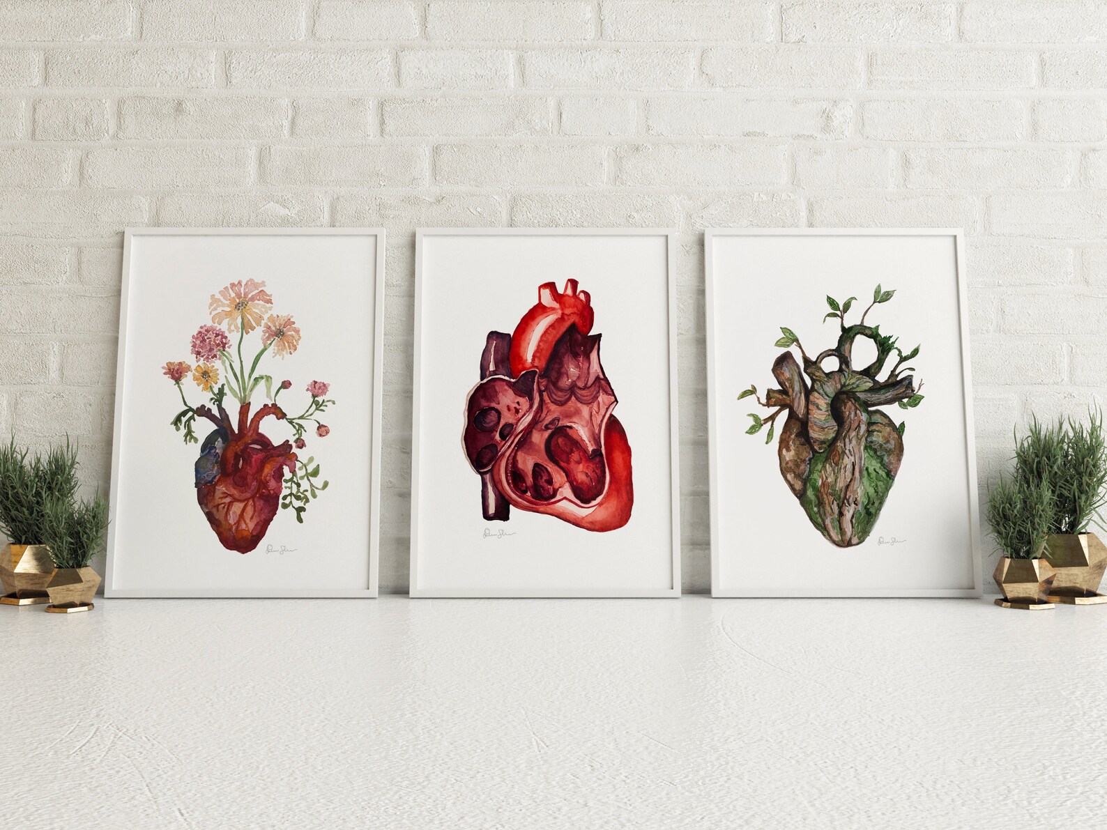 Right Ventricle Watercolor Print - Cardiology Art - Anatomy Wall Art ...