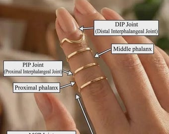 Adjustable Splint Arthritis Ring for Swan Neck, EDS & Hypermobility | Handmade Finger Deformity Support Splint Ring for Joint Pain Relief