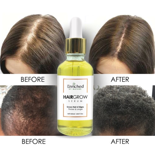Hair Growth Serum Thinning Hair Edges Hair Treatment Etsy