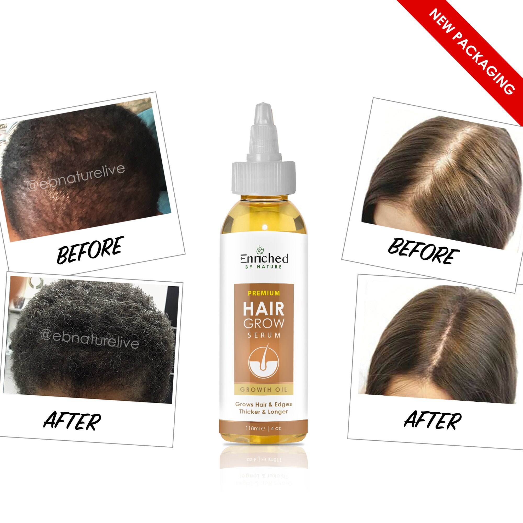 Hair Growth Serum Thinning Hair Edges Hair Treatment Etsy