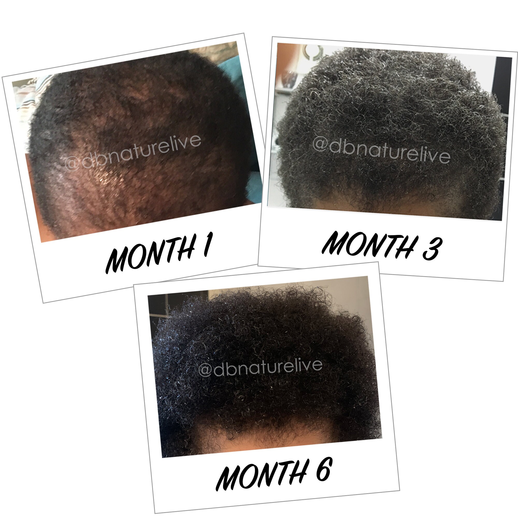 Hair Growth Pomade Natural Edges Hair Growth Serum Hair Etsy