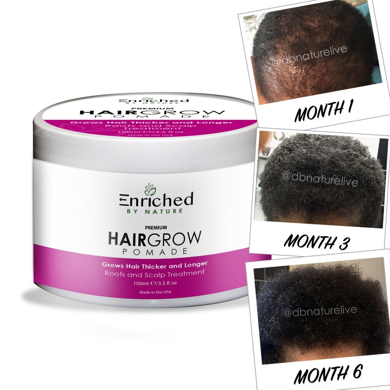 Hair Growth Pomade Natural Edges Hair Growth Serum Hair Etsy