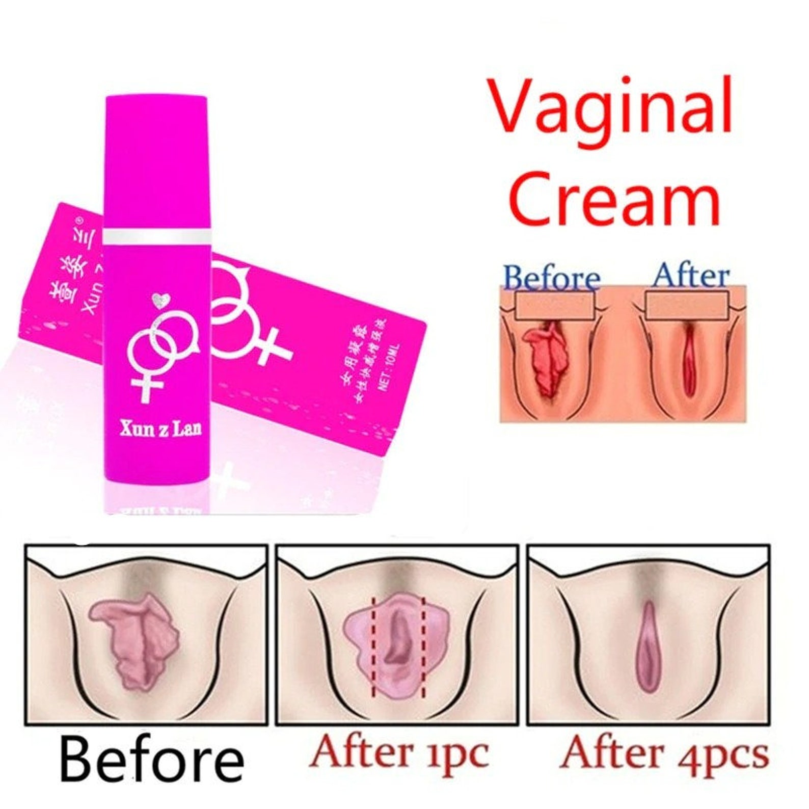 Vaginal tightening creams promise to make you feel like a virgin again