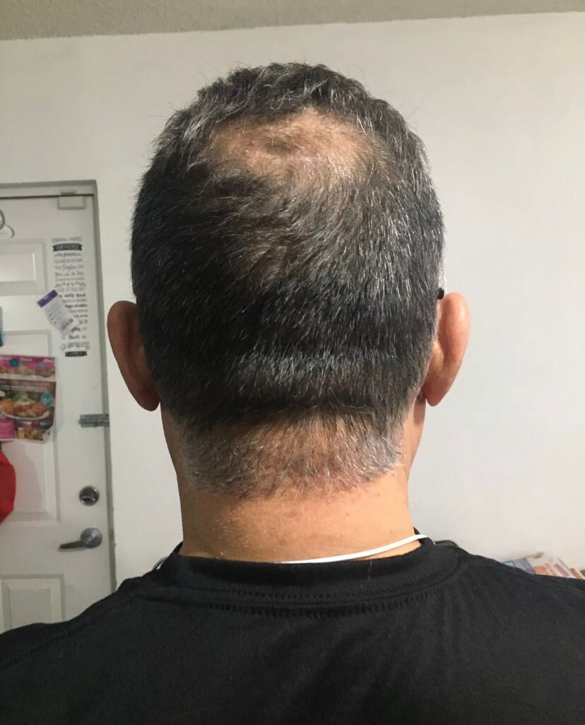batana oil hair growth
