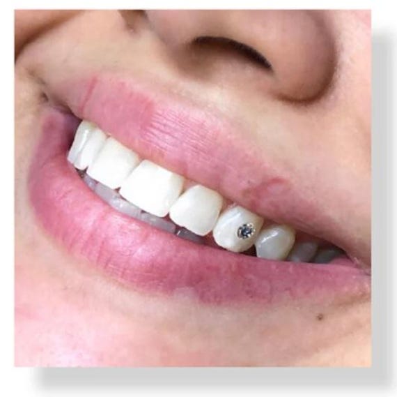 Tooth Gem Bonding Adhesive: Light Cure, Dental Grade (7mL)