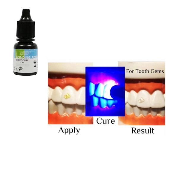 Tooth Gem Bonding Adhesive: Light Cure, Dental Grade (7mL)