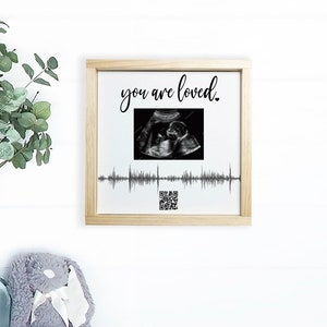 Soundwave Art QR code, Custom Canvas — Ultrasound Photo and Heartbeat Options, QR Code to Audio or Video of Your Sonogram