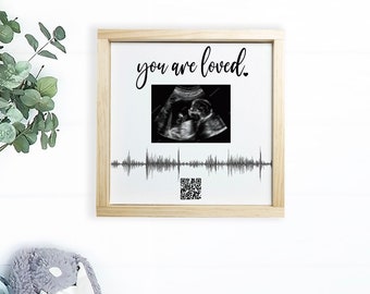 Soundwave Art QR code, Custom Canvas — Ultrasound Photo and Heartbeat Options, QR Code to Audio or Video of Your Sonogram