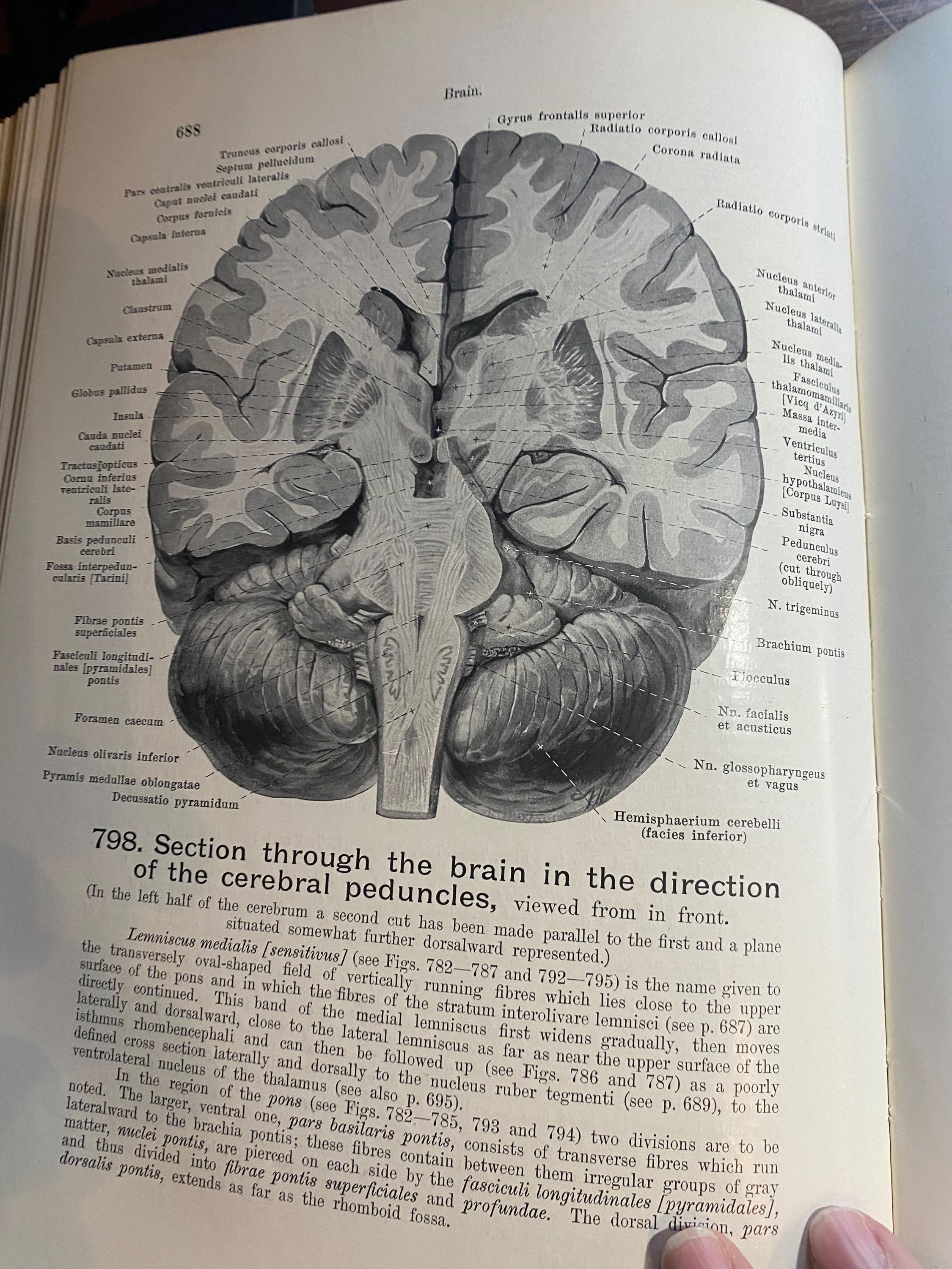医学本　人解剖学ハンドアトラス　ヴェルナー・シュパルテホルツ著 Hand Atlas of Human Anatomy by Spalteholz, Werner: Fine Full