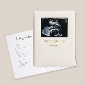 May include: A cream-colored pregnancy journal with a rectangular cutout on the cover displaying a black and white ultrasound image. The text 'my pregnancy journal' is printed in gold. An open page shows a checklist titled 'The Hospital Bag'.