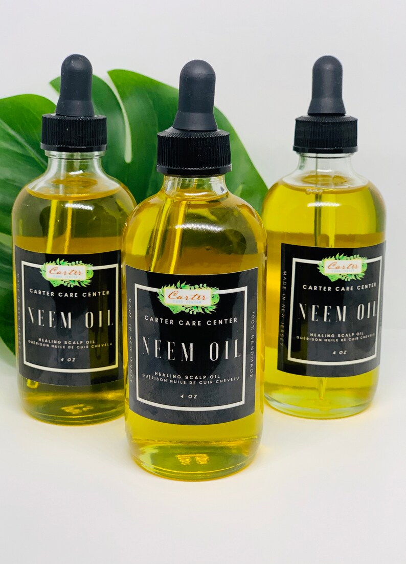 Hair Oil Scalp Oil Body Oil Eczema Psoriasis Dry Flaky Etsy