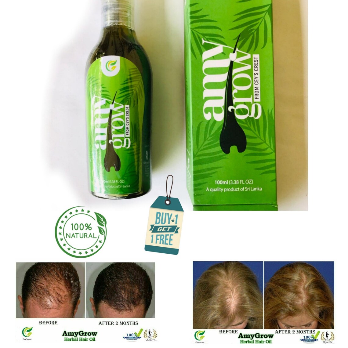 Buy Amygrow Hair Oil Best & Fastest Hair Loss Treatment Regrowth