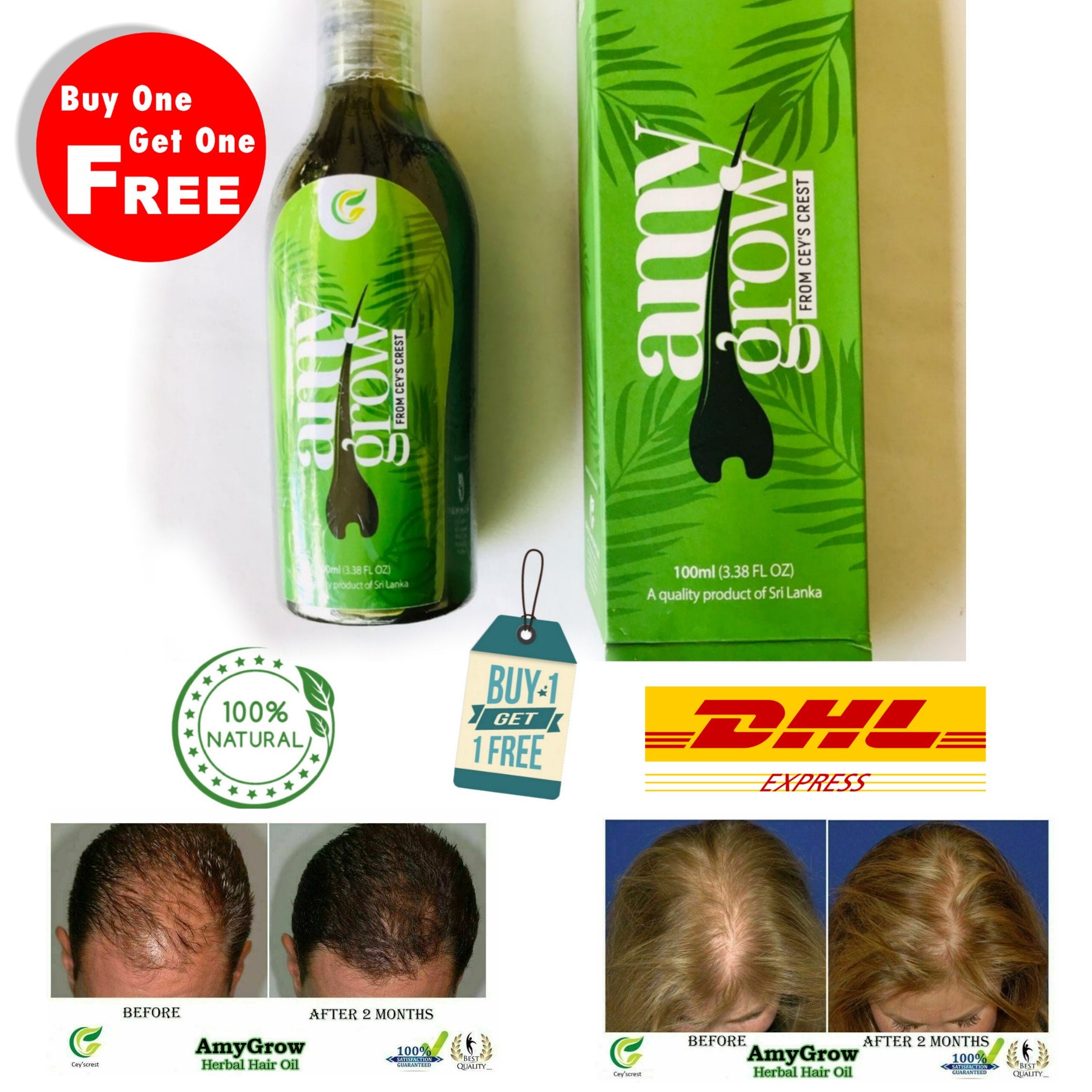 Buy Amygrow Hair Oil Best & Fastest Hair Loss Treatment Regrowth Online in India - Etsy Buy Amygrow Hair Oil Best & Fastest Hair Loss Treatment Regrowth Online in India - Etsy