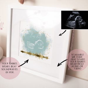 May include: A framed print with a blue watercolour background and gold foil accents. The print features a baby's ultrasound image and a gold foil heartbeat soundwave. The text "Baby Kiss" is written in gold foil. A scannable QR code is included that loads the baby's heartbeat audio or video.