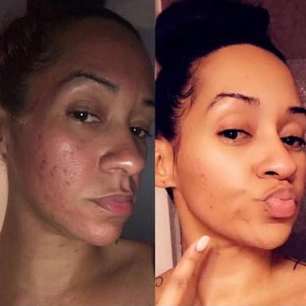 Savon au curcuma (avec 100 % d'aloe vera par Aloe4Life)