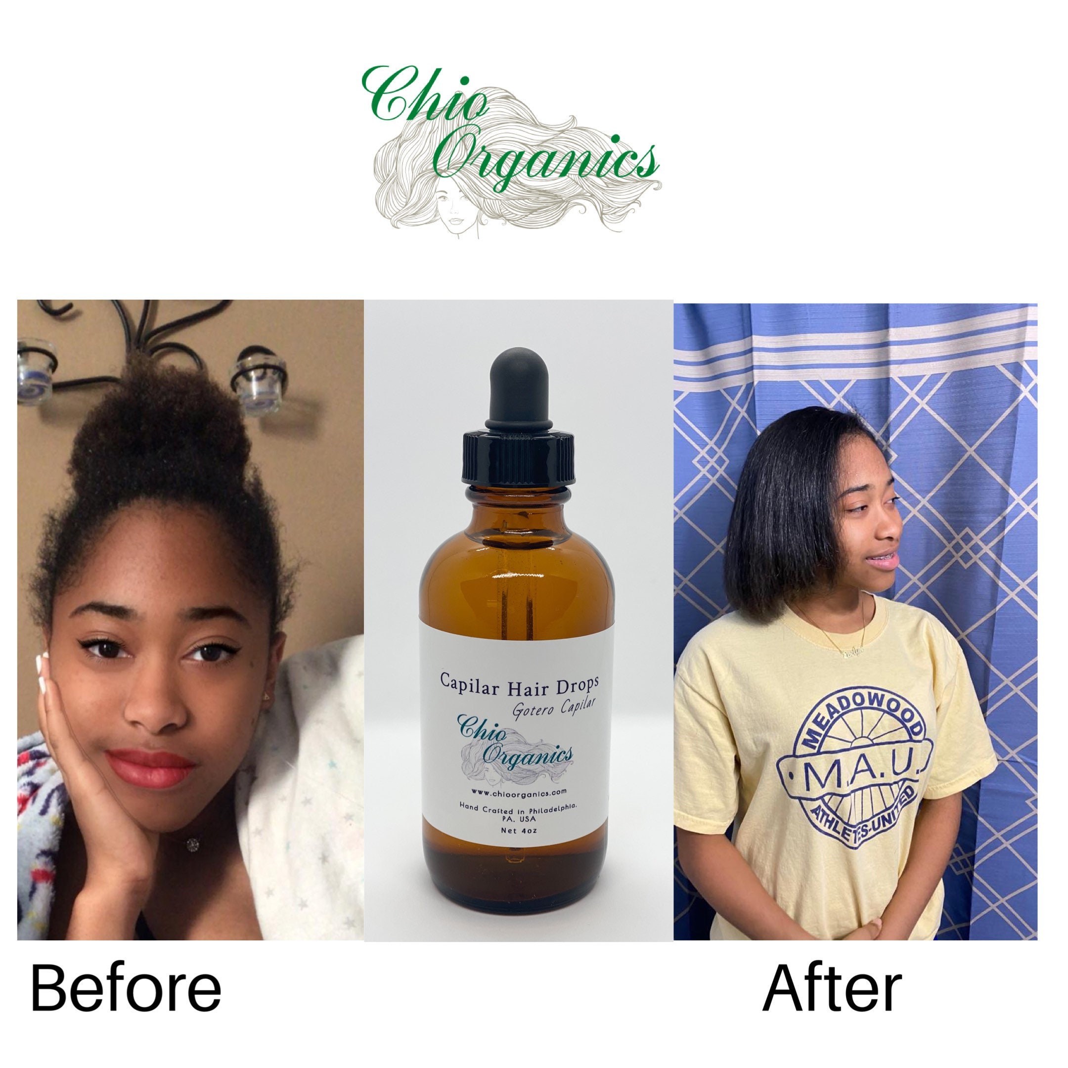 Alopecia Hair Growth With Organic Herb & Essential Oils 4oz Etsy